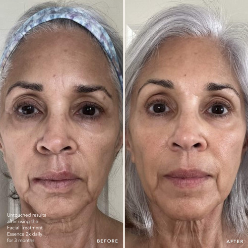 SK-II’s brand new skincare set featuring the award-winning Facial Treatment Essence and three Facial Treatment Masks slide4