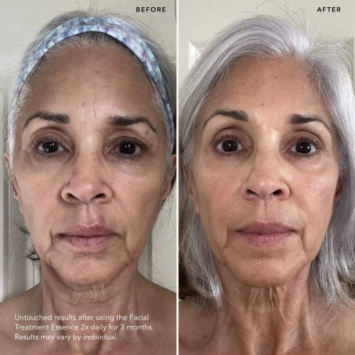 SK-II First Experience Kit with facial treatment essence, facial treatment clear lotion, and a facial treatment mask slider2