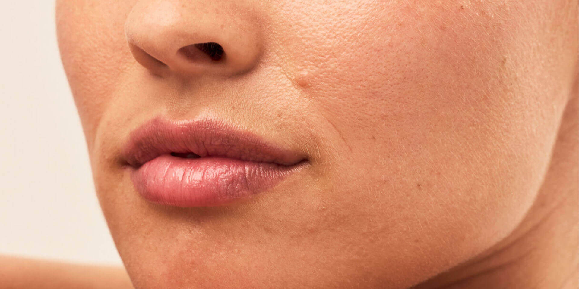 Hyperpigmentation & Dark Spots on Face: 4 Prevention Tips